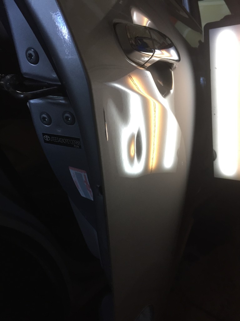 Dents